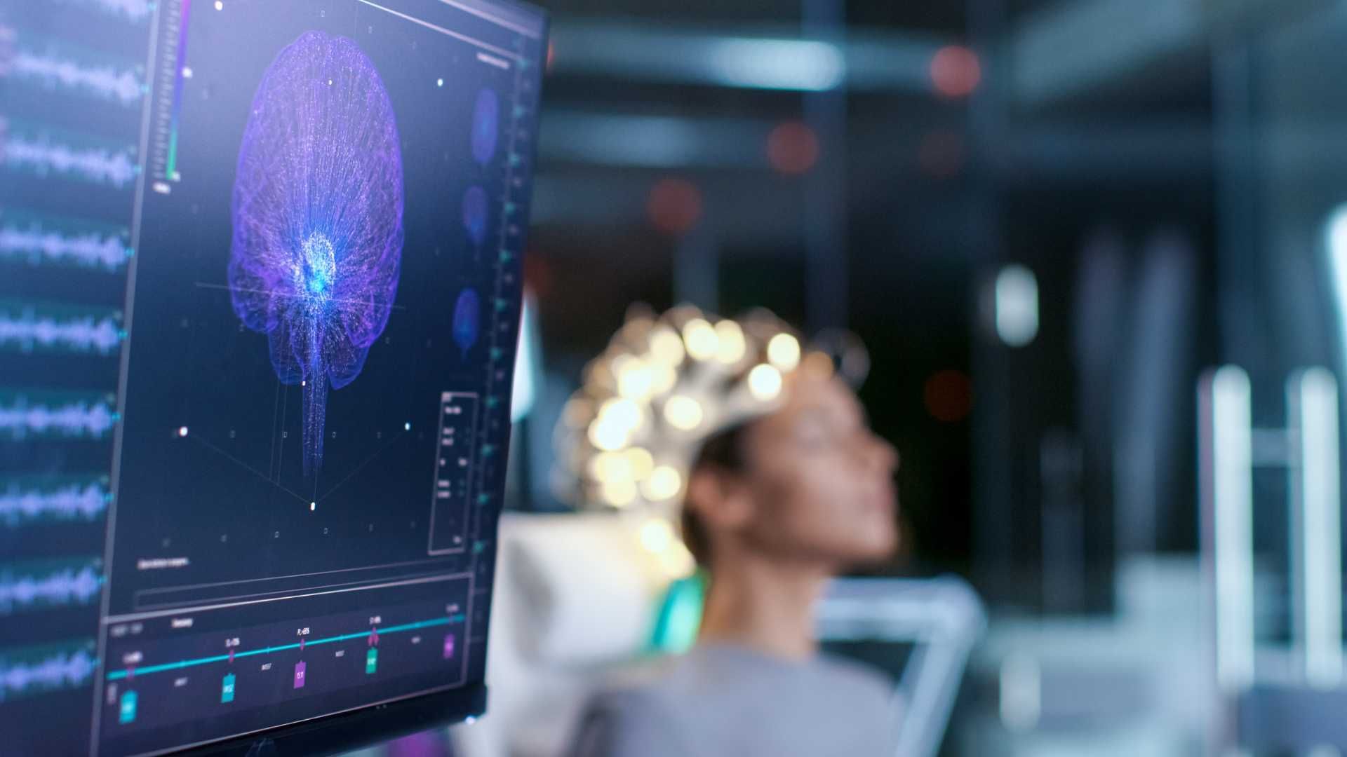 تحریک الکتریکی مغز با دستگاه tDCS برای درمان اختلالات روانپزشکی (هر جلسه ، 20 دقیقه )