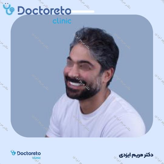 لمینت سرامیکی ایمکس آلمان (هر واحد)