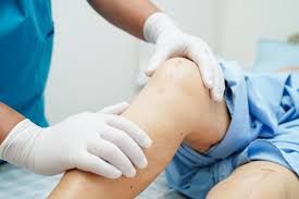 تزریق ژل درون مفصلی