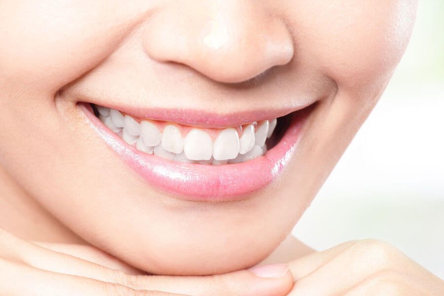 آفیس بلیچینگ برزیلی (هر فک)