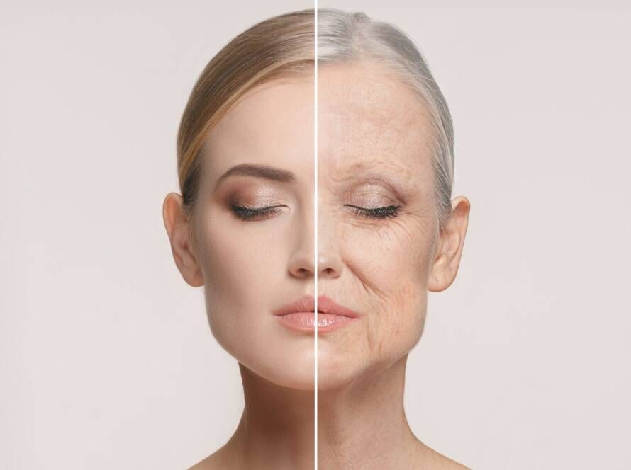 جوانسازی صورت با مزوژل پروفایلو استرکچرا (هر جلسه)