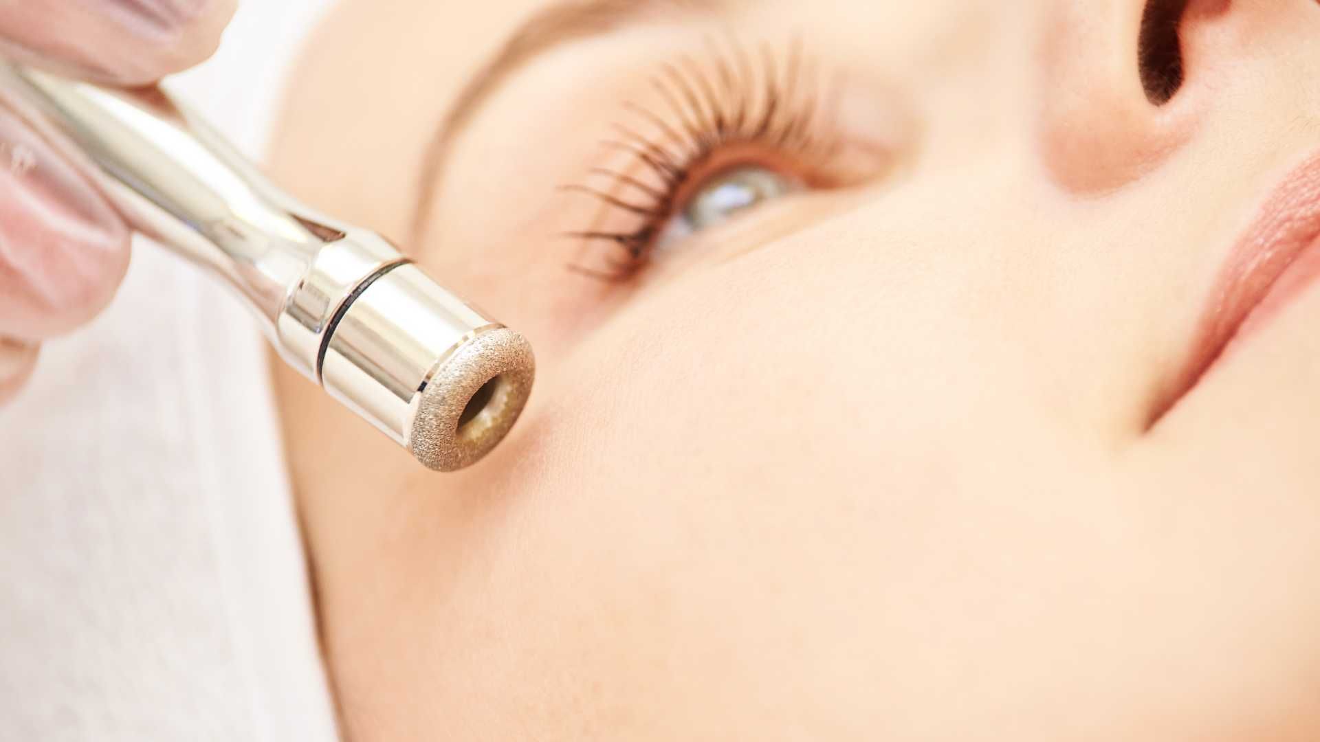 مزوتراپی رفع چین و چروک صورت با کوکتل مزولایک و میکرونیدلینگ