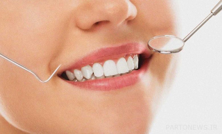 ونیر کامپوزیت آستریا ژاپن (هر واحد)