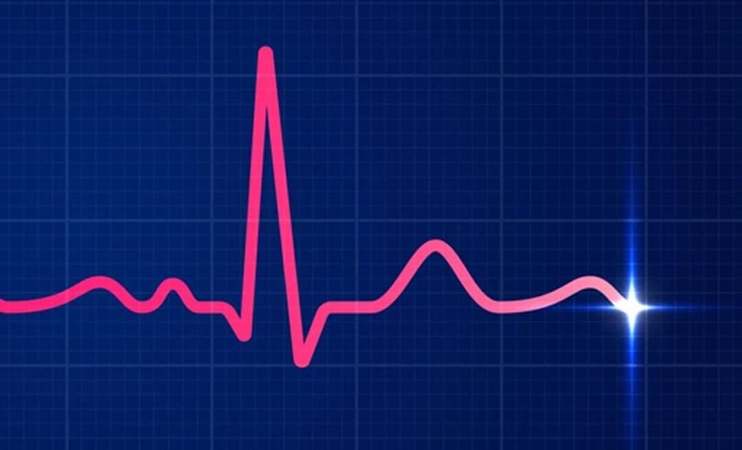 نوار مغز (EEG)
