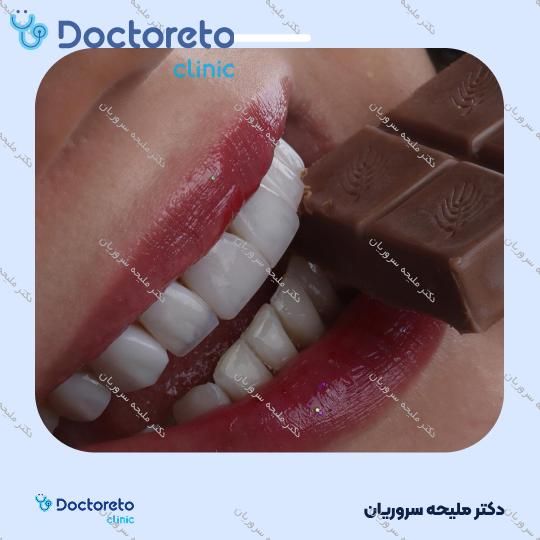 ونیر کامپوزیت (هر واحد)