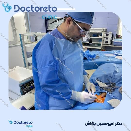 برداشتن زگیل تناسلی (هر جلسه)