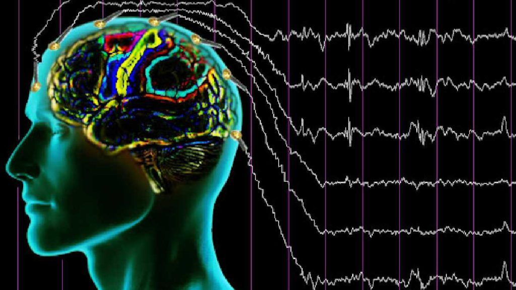 نوار مغزی EEG