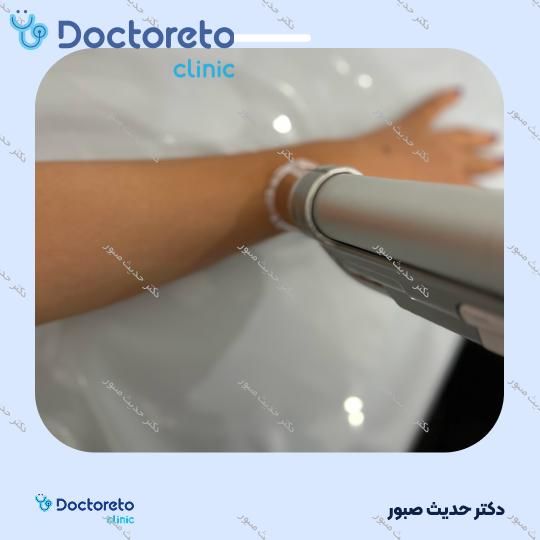 لیزر موهای زائد بانوان (شکم) با دستگاه SMARTRION.COMBI (هرجلسه)