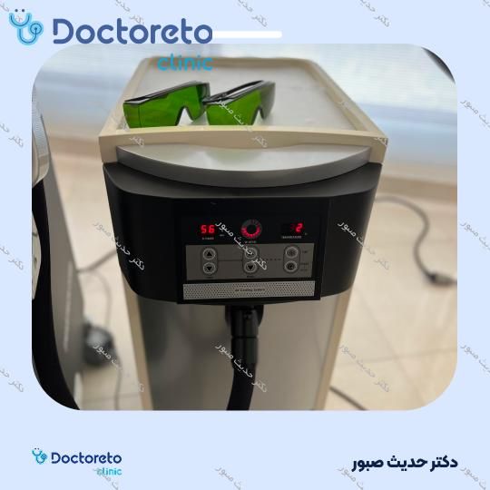 لیزر موهای زائد بانوان (ران پا) با دستگاه SMARTRION.COMBI (هرجلسه)