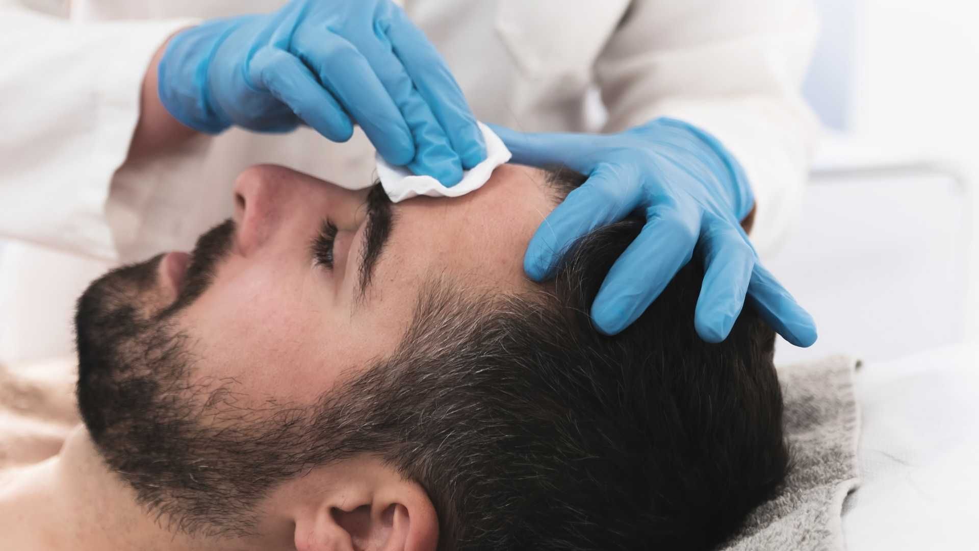 مزوتراپی و کربوکسی تراپی مو (هر جلسه)