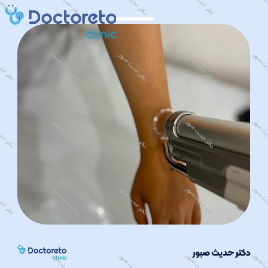 لیزر موهای زائد آقایان فول بادی ( کل دست ، کل پا ، زیر بغل ) با دستگاه SMARTRION.COMBI (هرجلسه)