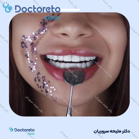 ونیر کامپوزیت (هر واحد)