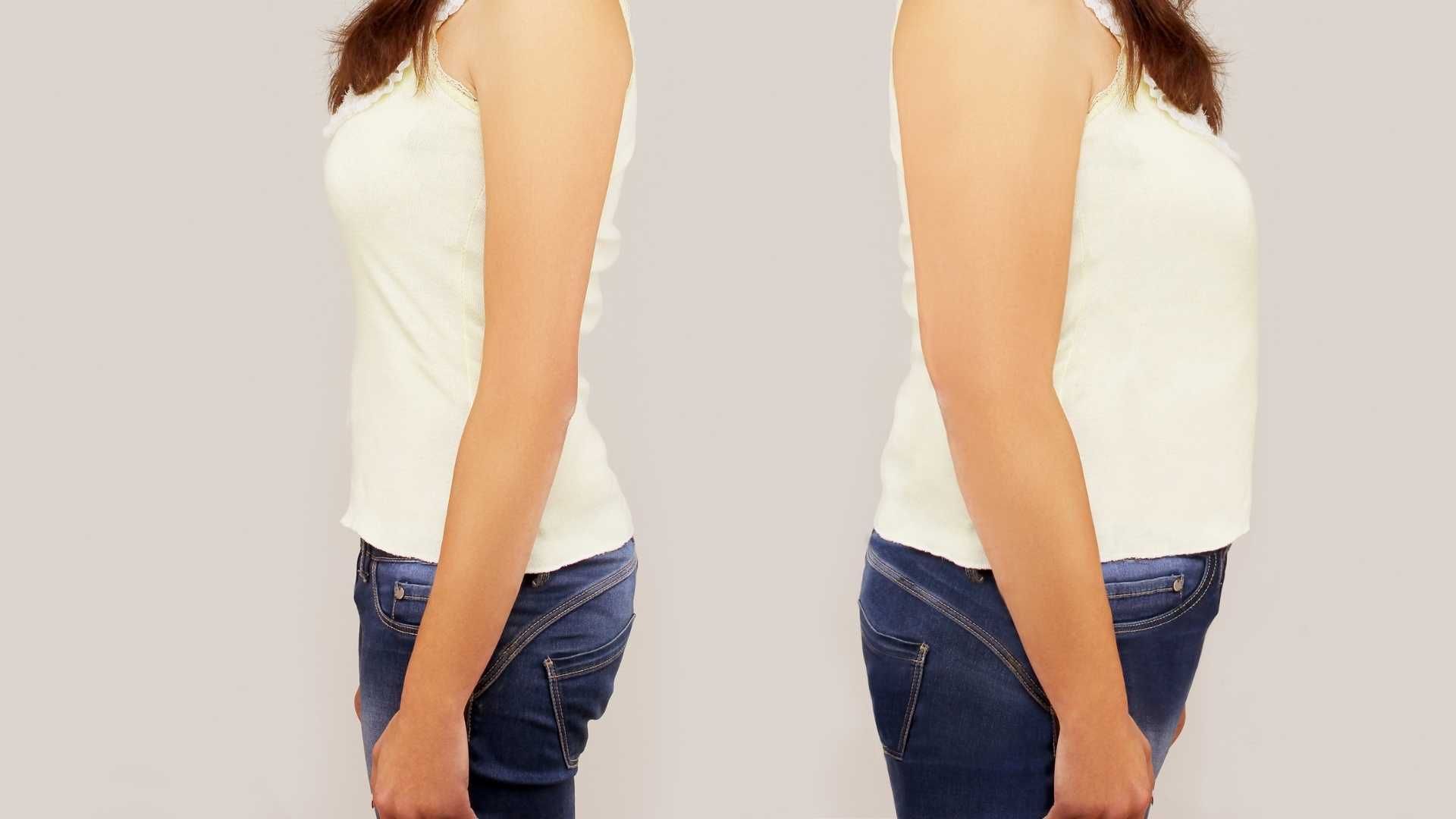 مزوتراپی چربی سوز غبغب