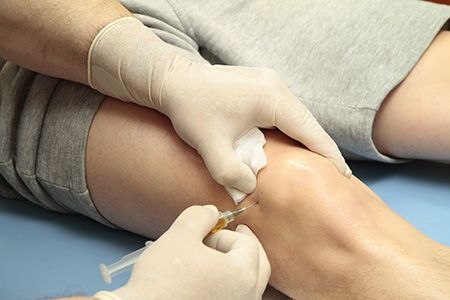 درمان ساییدگی مفاصل با تزریق ژل هیالورونیک اسید