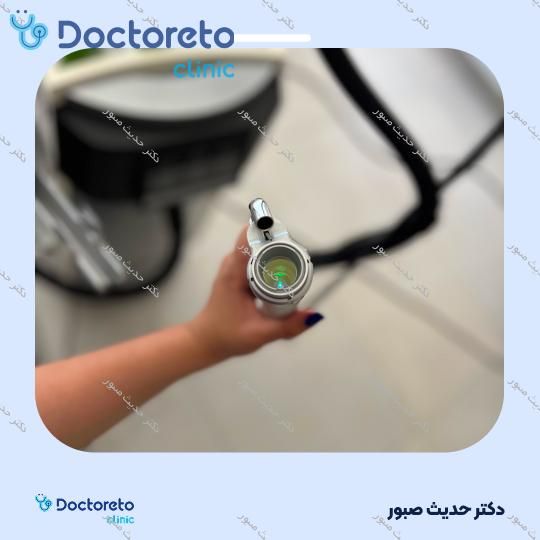 لیزر موهای زائد بانوان (ران پا) با دستگاه SMARTRION.COMBI (هرجلسه)