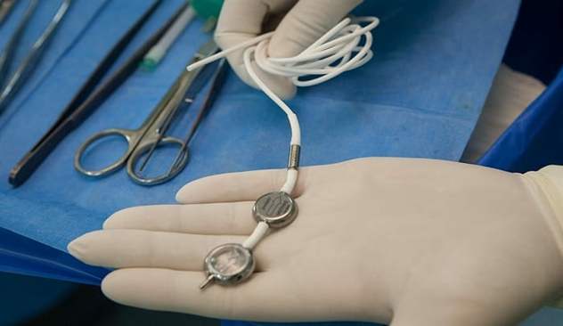 عمل جراحی شانت گذاری مغزی