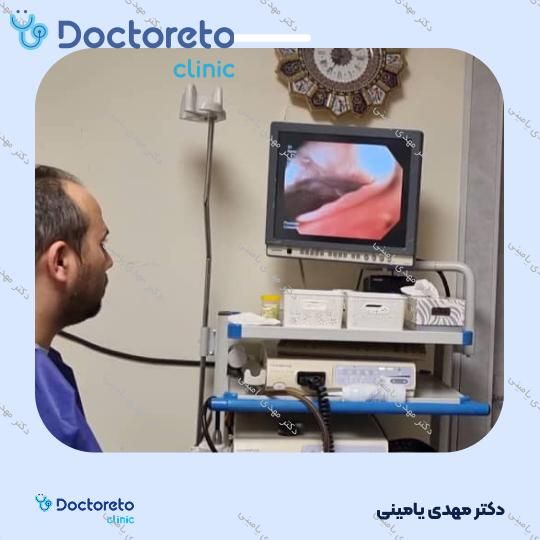 آندو کولونوسکوپی