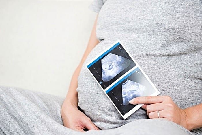 سونوگرافی انومالی و داپلر سلامت جنین