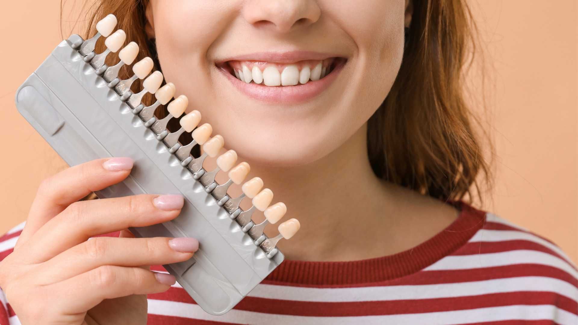 روکش دندان (هر واحد)⬅️ دکتر علیرضا فودازی در تهران 1