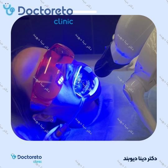 بلیچینگ دندان (سفید کردن دندان) دکتر دینا دیوبند در تهران 1