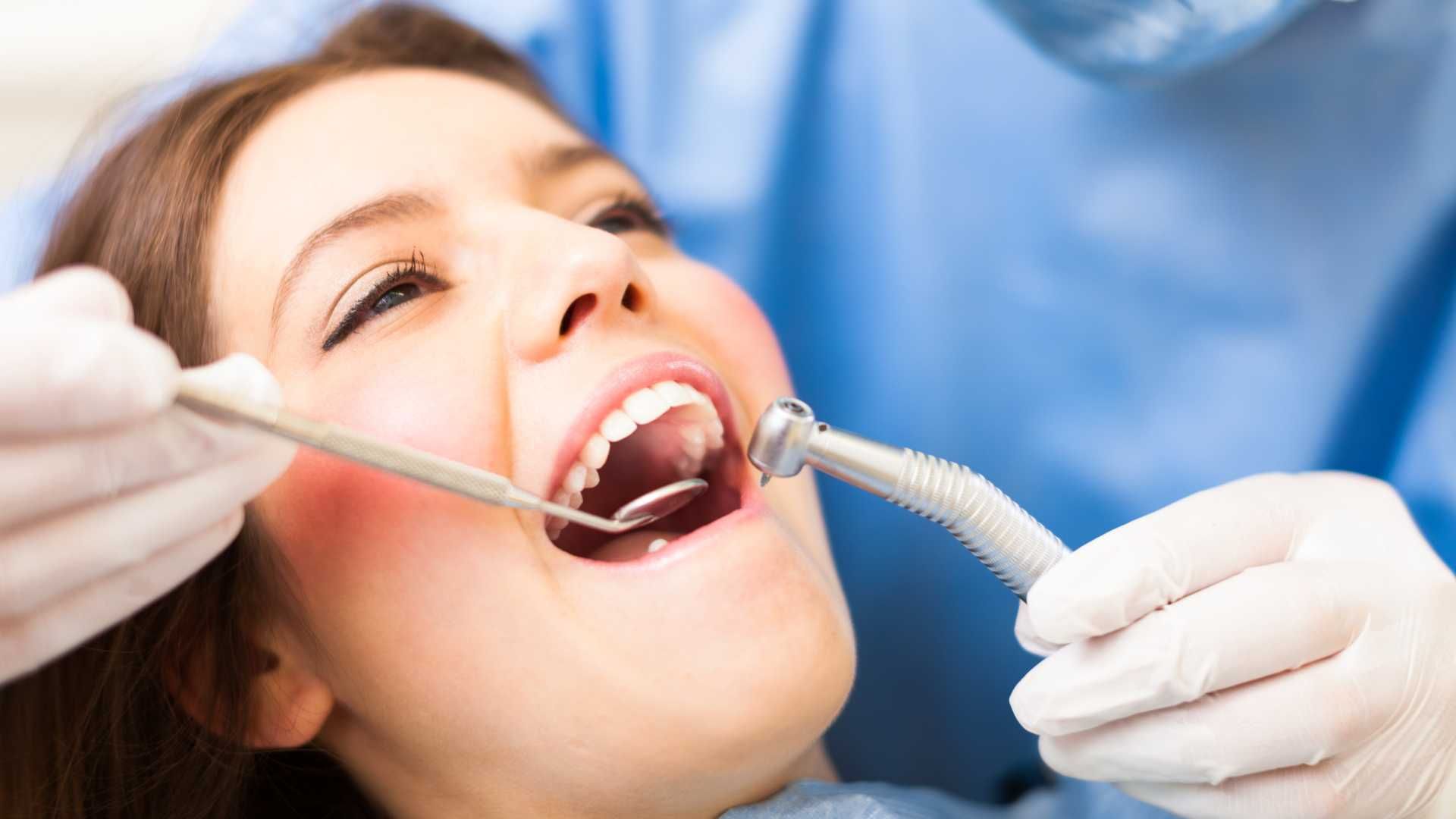 جرم گیری کامل دندان‌های دو فک با بروساژ🦷 دکتر مبینا دالوندی در تهران 1