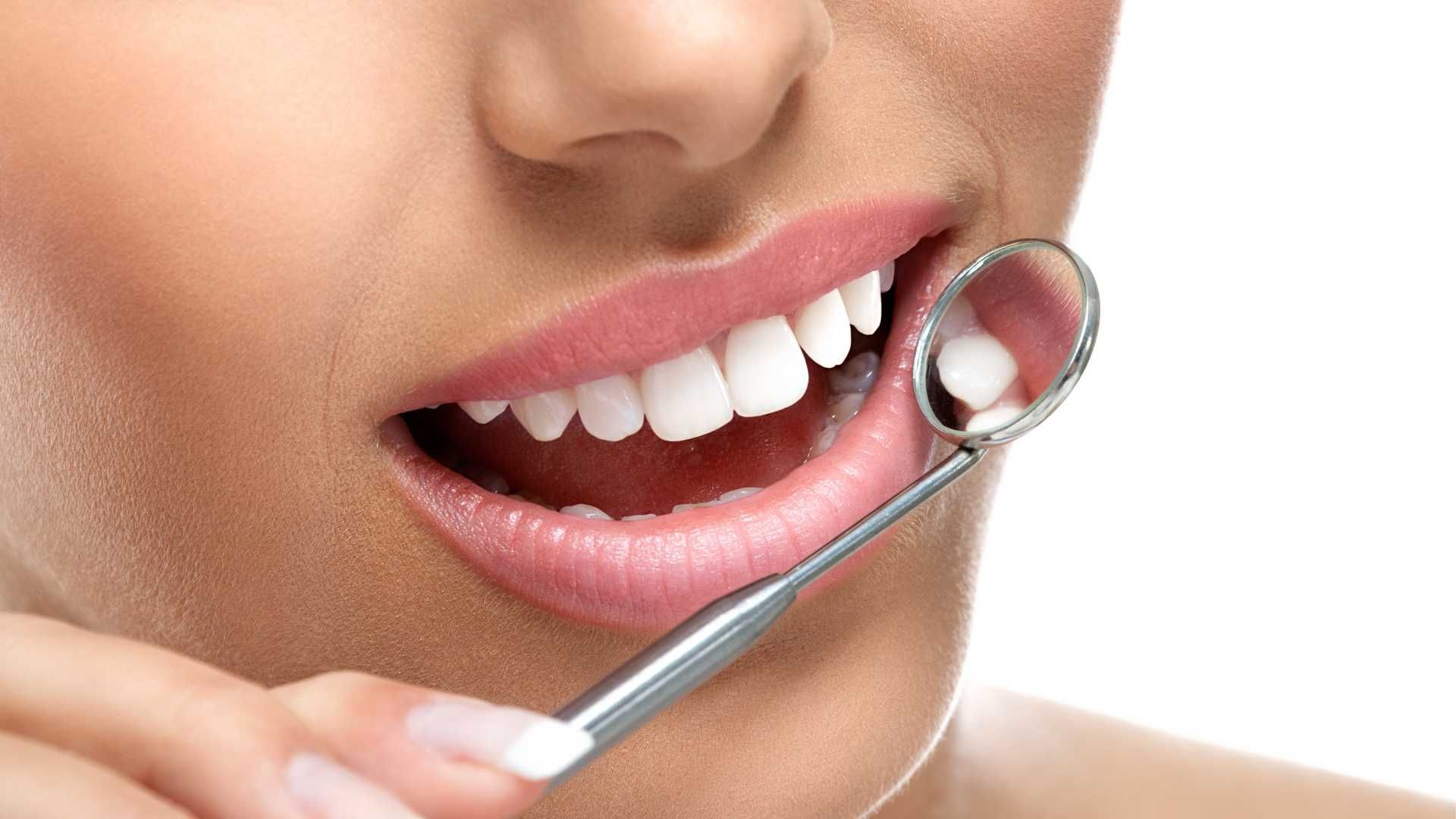 لمینت دندان (هر واحد)⬅️ دکتر سجاد صفری فرشچی در تهران 1