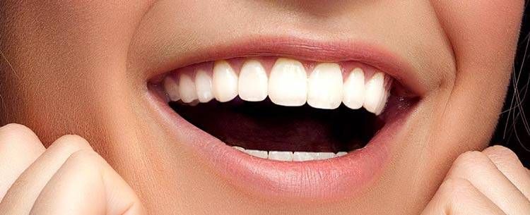 جرم گیری کامل دندان‌های دو فک با بروساژ🦷 دکتر فاطمه روستا در شیراز 1