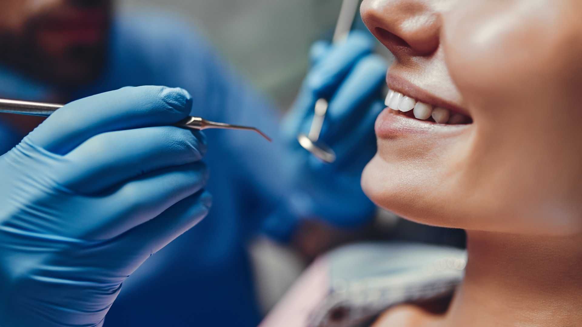 جرم گیری کامل دندان‌های دو فک با بروساژ🦷 دکتر نگار شکرچی زاده در اصفهان 1